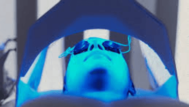 Image for LED Light Therapy for Acne